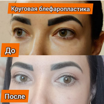 пластическая операция лица