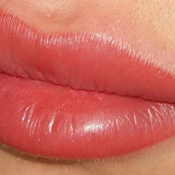 відразу після процедури