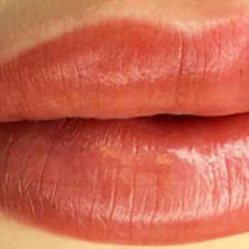 одразу після процедури