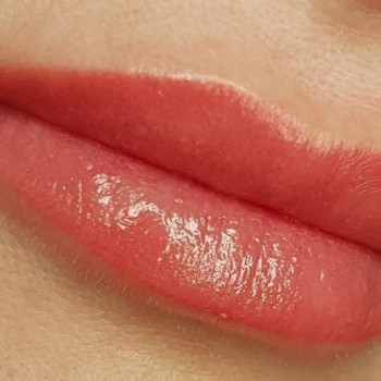 одразу після процедури