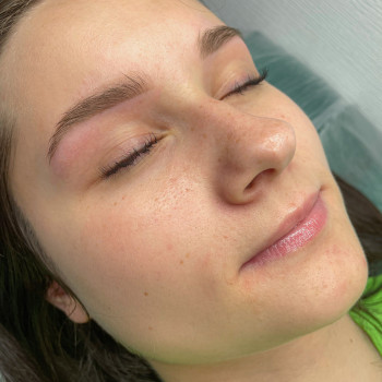 загоєнний перманент брів через рік