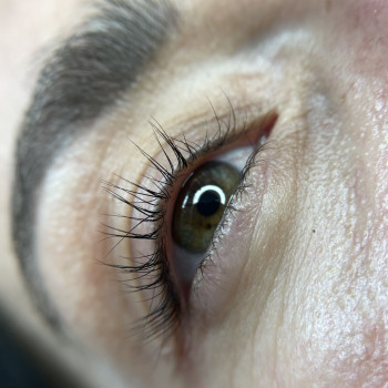 Перед корекцією