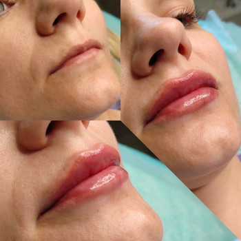 Наталия Мартыненко, Сумы Фото - 54