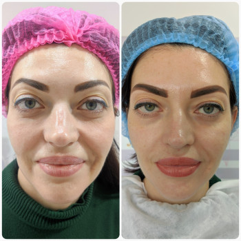 Татуаж брів губ апаратна косметологія обличчя, фото -  JULIA BEAUTY STUDIO