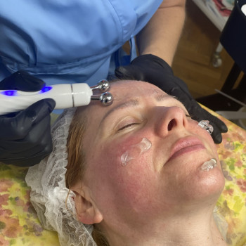 Массаж лица
                    Косметолог-инъекционист Виктория Киев