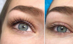 Ламінування вій Косметолог-ін'єкціоніст Людмила Київ