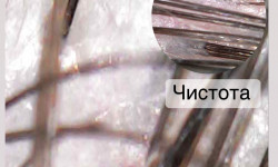 Трихологічний пілінг по типу проблеми Тритментолог Олена Винница
