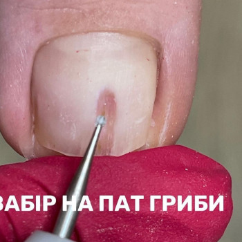 лікування стопи