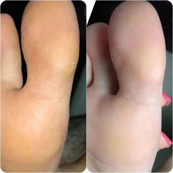 Педикюр гель лак
                    Мастер маникюра Наталия Одесса