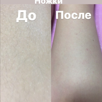 Шугаринг ноги повністю