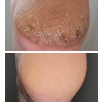 Руслана Петровна Гончарова, Одесса Фото - 55