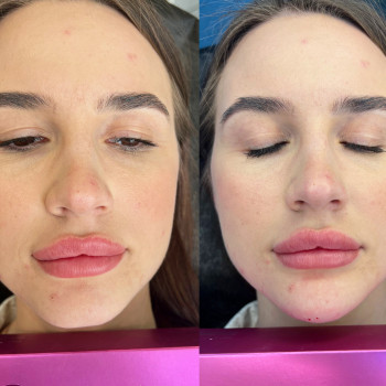 Любовь Бут, Киев Фото - 8