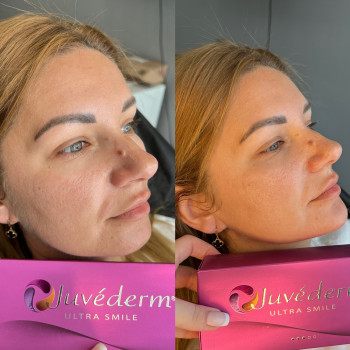 Любовь Бут, Киев Фото - 14