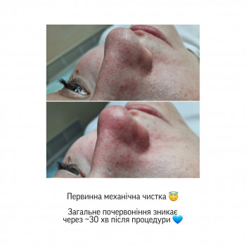 Єлизавета Закалічна, Київ Фото - 8