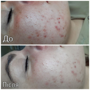 Єлизавета Закалічна, Київ Фото - 9