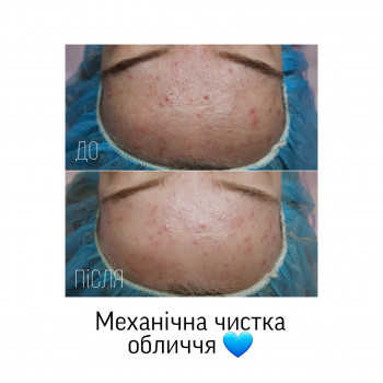 Єлизавета Закалічна, Київ Фото - 15