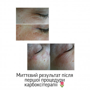 Єлизавета Закалічна, Київ Фото - 17