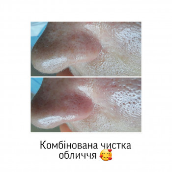 Єлизавета Закалічна, Київ Фото - 18