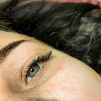 Эффект лисий