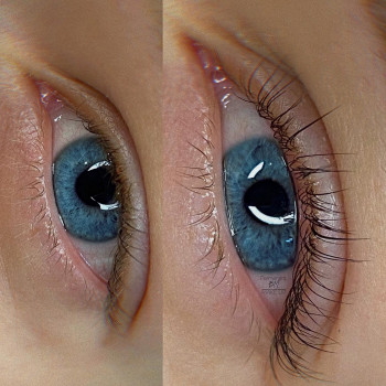 Ламинирование ресниц

 