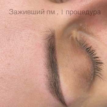 Загоєні брови
 
 