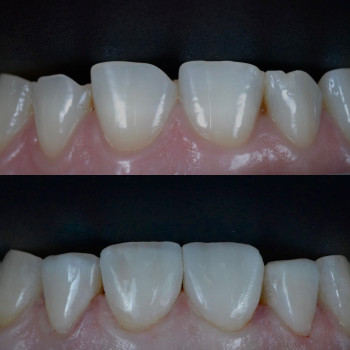 Вікторія Сучик, Рівне Фото - 2