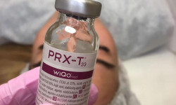 Пілінг PRX-T33 Студия татуажа Permanent face Ивано-Франковск
