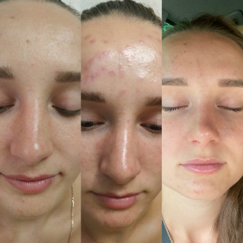 до/сразу после/на следующий день