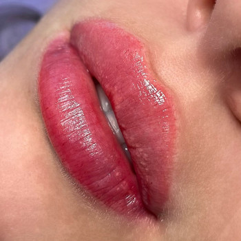 Работа с анестезией