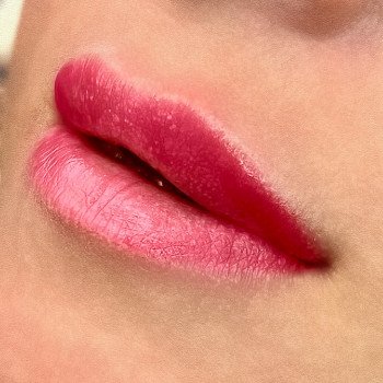 Увеличение губ
                    Косметолог-инъекционист Татьяна Одесса