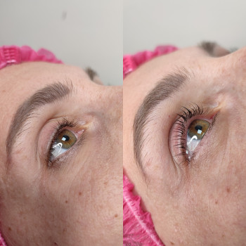 Ламінування вій
                    Тритментолог Юлия Житомир