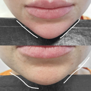 Ліна Гетьман, Тернополь Фото - 10