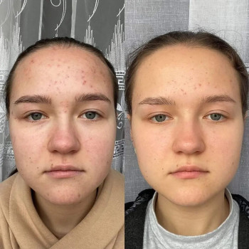 Ліна Гетьман, Тернополь Фото - 11