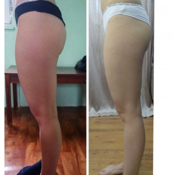 Антицелюлітний масаж. Корекція фігури. Магістральний лімфодренаж / Антицеллюлитный массаж. Коррекция фигуры. Магистральный лимфодренаж
                    Массажист Ирина Днепр