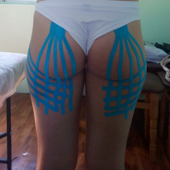 Кінезіотейпування / Кинезиотейпирование
                    Массажист Ирина Днепр