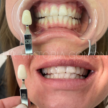 Вікторія Гомон-Павловська, Черкассы Фото - 16