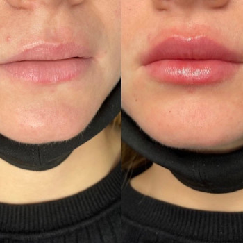 Вікторія Гомон-Павловська, Черкассы Фото - 19