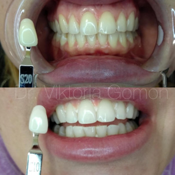 Вікторія Гомон-Павловська, Черкассы Фото - 14