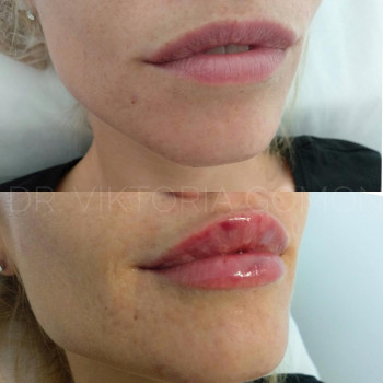 Вікторія Гомон-Павловська, Черкассы Фото - 7