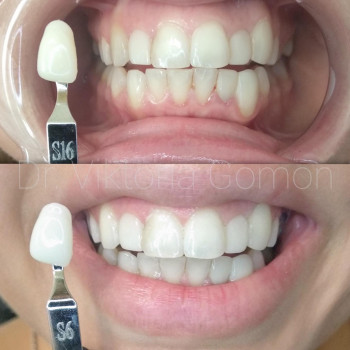 Вікторія Гомон-Павловська, Черкассы Фото - 10