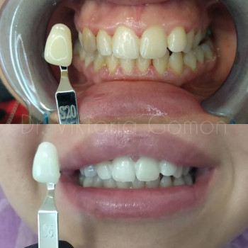 Вікторія Гомон-Павловська, Черкассы Фото - 8