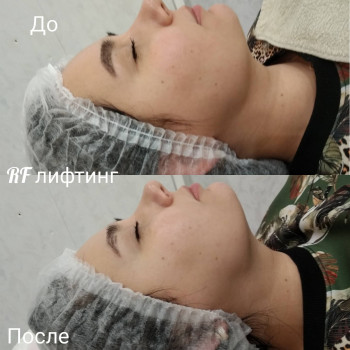 
                    Косметолог-естетист Наталья Дніпро