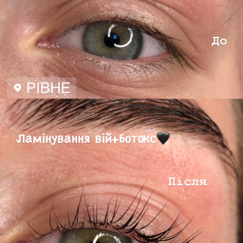 Світлана Сухан, Рівне Фото - 67