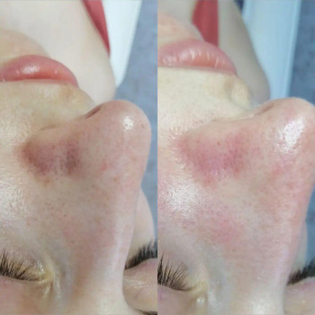 Алёна Ягодина, Суми Фото - 13