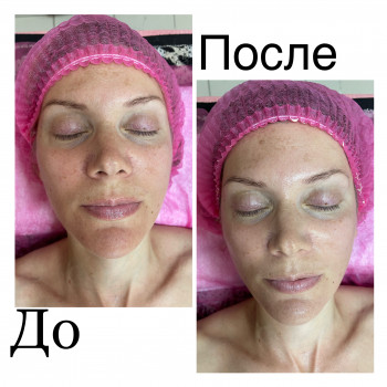 Людмила Сузима, Полтава Фото - 5