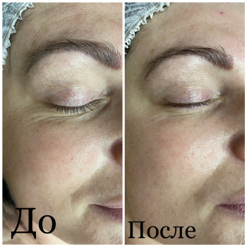 Людмила Сузима, Полтава Фото - 6