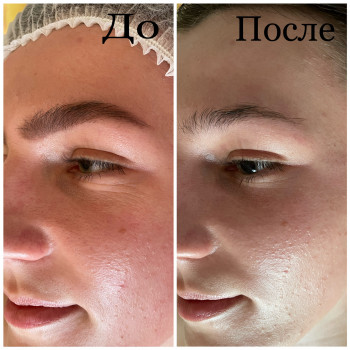 Людмила Сузима, Полтава Фото - 8