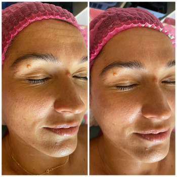 Людмила Сузима, Полтава Фото - 9