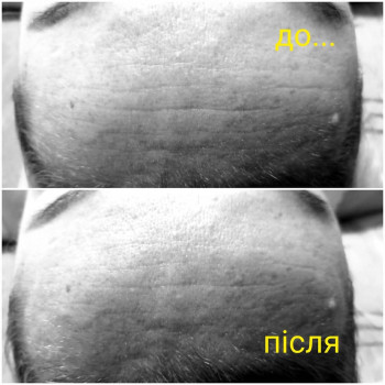 Марина Тодерян, Черновцы Фото - 10