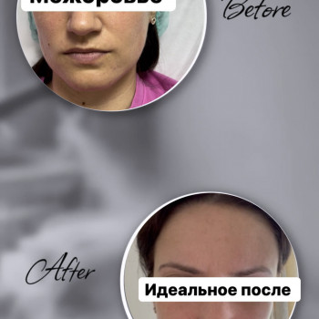 Фото з портфоліо косметолога Марія Соболева (Київ)